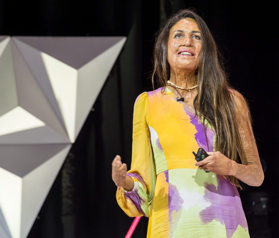 Celebrity Speaker Turia Pitt Celebrity Speaker Turia Pitt on stage